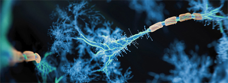 Neurofilament Light Chain