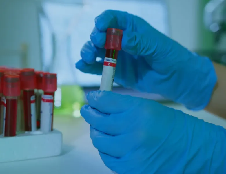 samples in test tubes; gloved hands handling a sample